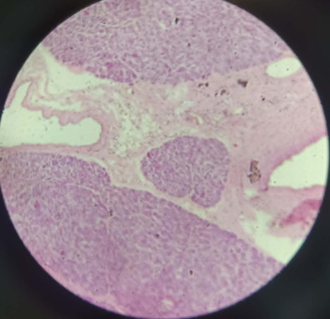 <p>Pancreas - HE (47)</p><ul><li><p>Exocrine<br>fully serosa tsini (they don’t have new epithelial cells), but will gain centroacinal cells inside the lumen<br></p></li><li><p>Endocrine<br>- lining house ions - endocrine (hormones)</p></li><li><p>islets of langerhans</p></li></ul><p></p>