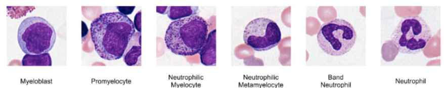 <ul><li><p><strong>Granulopoiesis</strong>—production of granulocytes</p><ul><li><p><strong>Myeloblasts</strong> give rise to <strong>promyelocytes</strong> with nonspecific granules</p></li><li><p><strong>Myelocytes</strong> have developed granules specific to a particular granulocyte subset</p></li><li><p><strong>Metamyelocytes</strong> are smaller with an indented nucleus</p></li><li><p>Band (stab) cells are the last stage before they enter blood</p></li><li><p>Fully mature granulocytes</p></li></ul></li></ul><p></p>