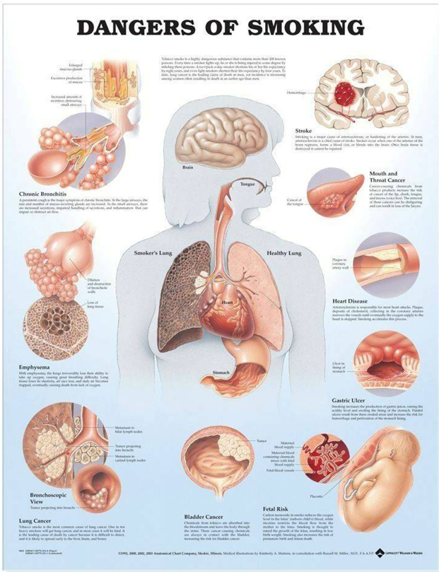 <p>Causes respiratory changes with increased chance of:</p><ul><li><p>Respiratory Infections</p></li><li><p>Cellular or Genetic Changes to the Lungs</p></li><li><p>Emphysema (Permanent Alveoli Damage)</p></li><li><p>Cancer of the Lungs, Esophagus, Stomach, and Pancreas</p></li><li><p>Stomach Ulcers</p></li><li><p>Atherosclerosis</p></li><li><p>Lower Birth Weight Babies in Pregnant Women</p></li><li><p>Poor Delivery of Oxygen and Nutrients to all Systemic Tissues</p></li><li><p>Bronchitis, Asthma, Ear Infections</p></li><li><p>All primary effects can also result from secondhand smoke </p></li></ul><p></p>