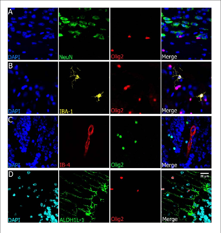 <p>Oligodendrocyte lineage cells </p>
