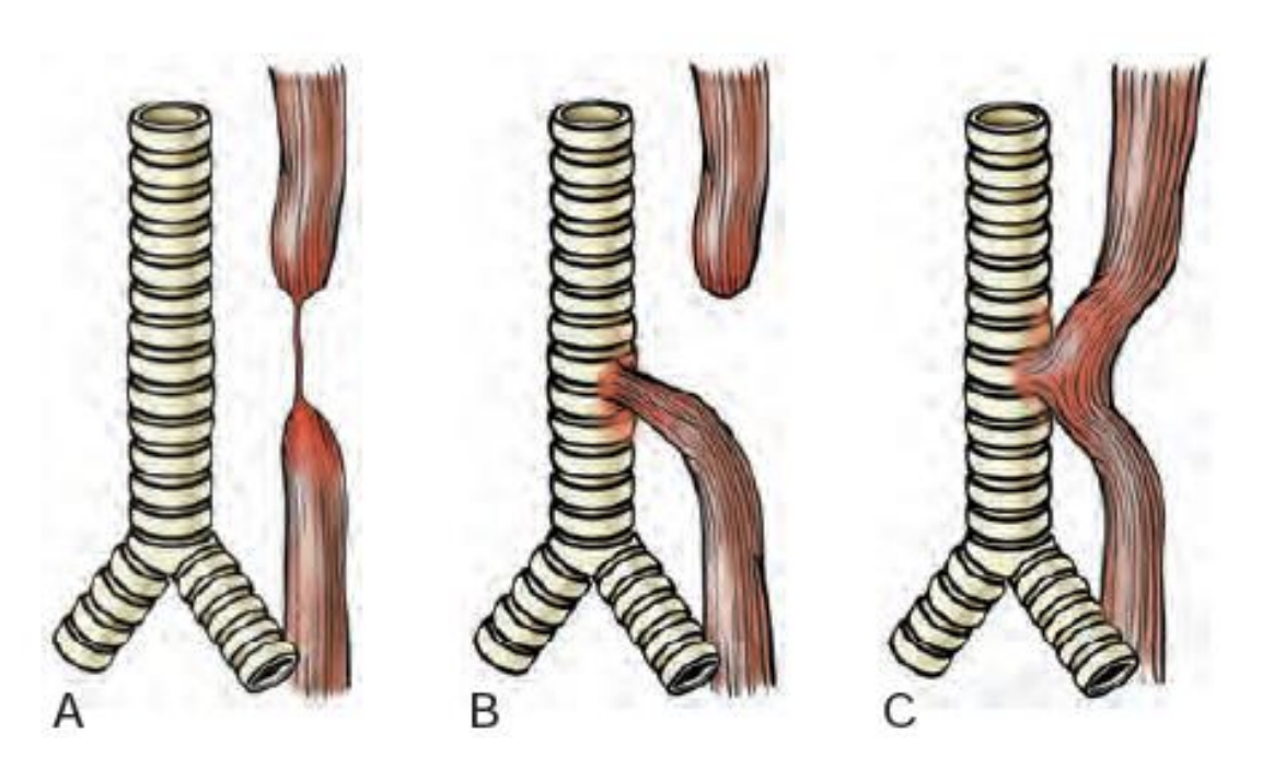 <p>diagnosis in A & B</p>