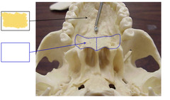 <p>Inferior View of Skull - Mandible Removed</p>