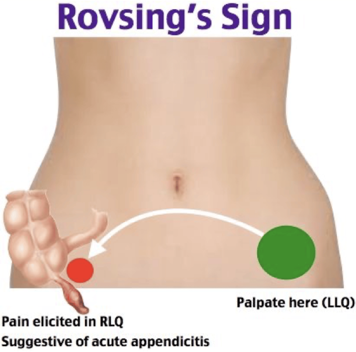 <p>palpation to LLQ</p>