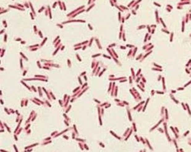 <p>Is this bacterium gram-positive or gram-negative?</p>