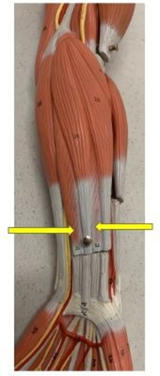 <p>flexes wrist and middle phalanges of fingers 2-5</p>