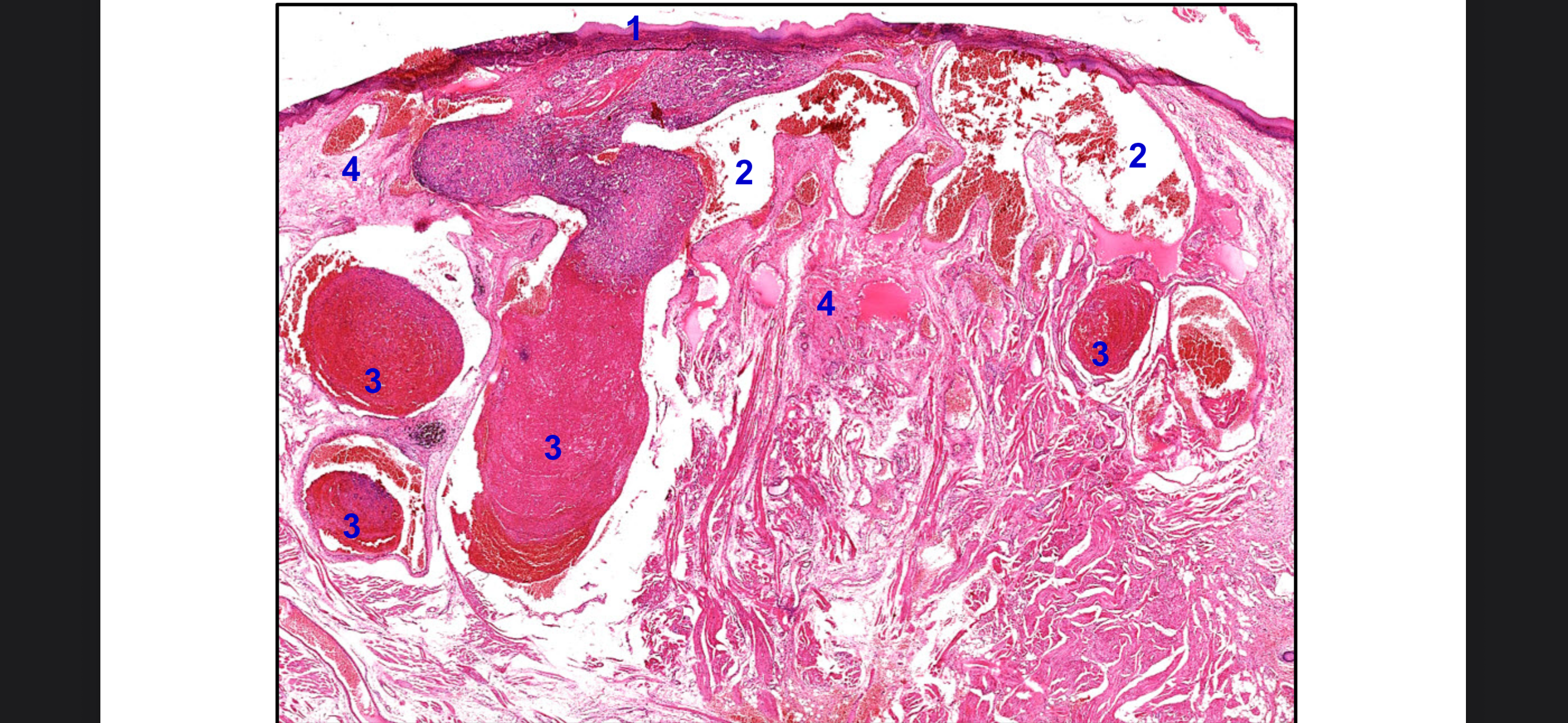 <p>Cấu trúc số 2</p>