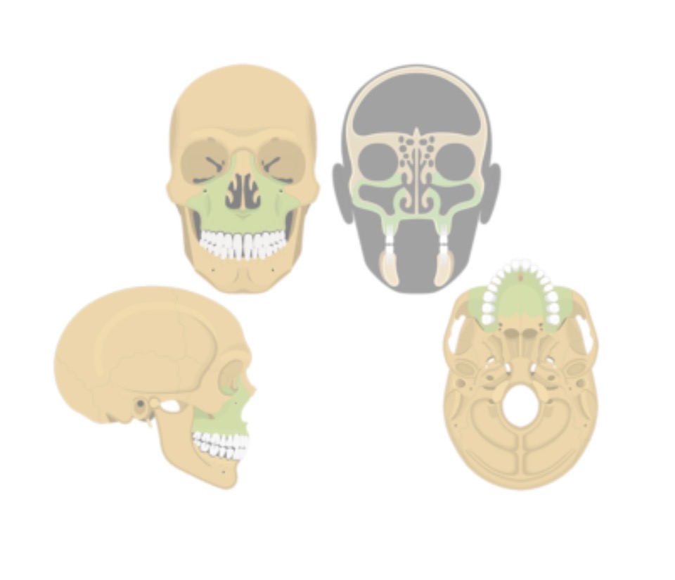 <p>Maxilla</p>