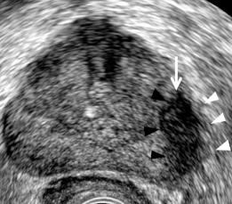 <p>Identify this image. </p>