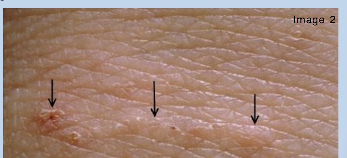 term image