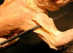 <p>muscle that works together with the clavotrapezius in the forward extension of the humerus (running) and assists in turning the head and flexing the elbow</p>