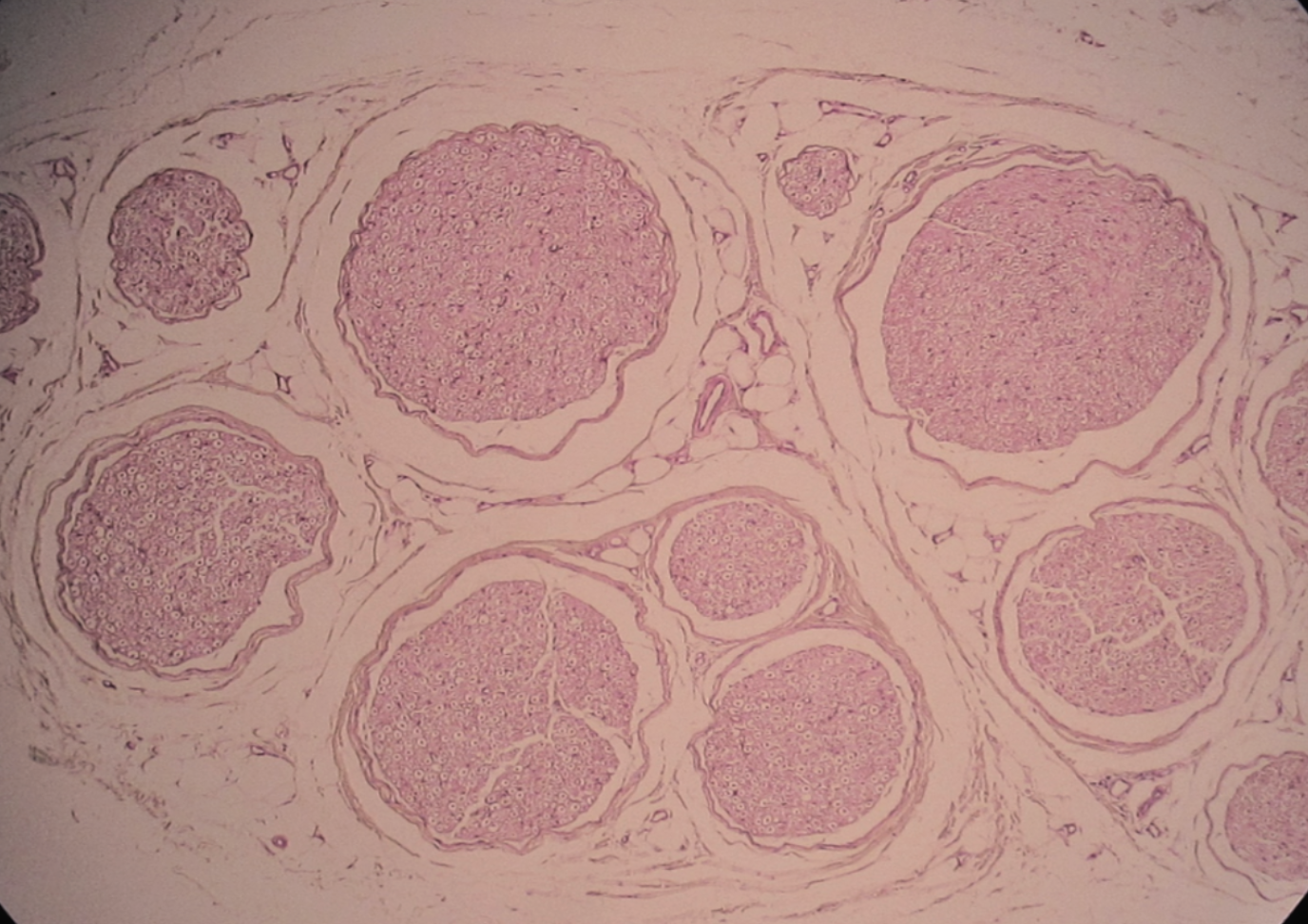 <p><strong>Identify the source of nervous tissue shown here.</strong></p>