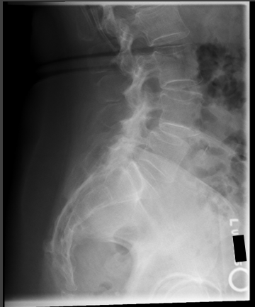 <p>critique for sacrum lateral </p>