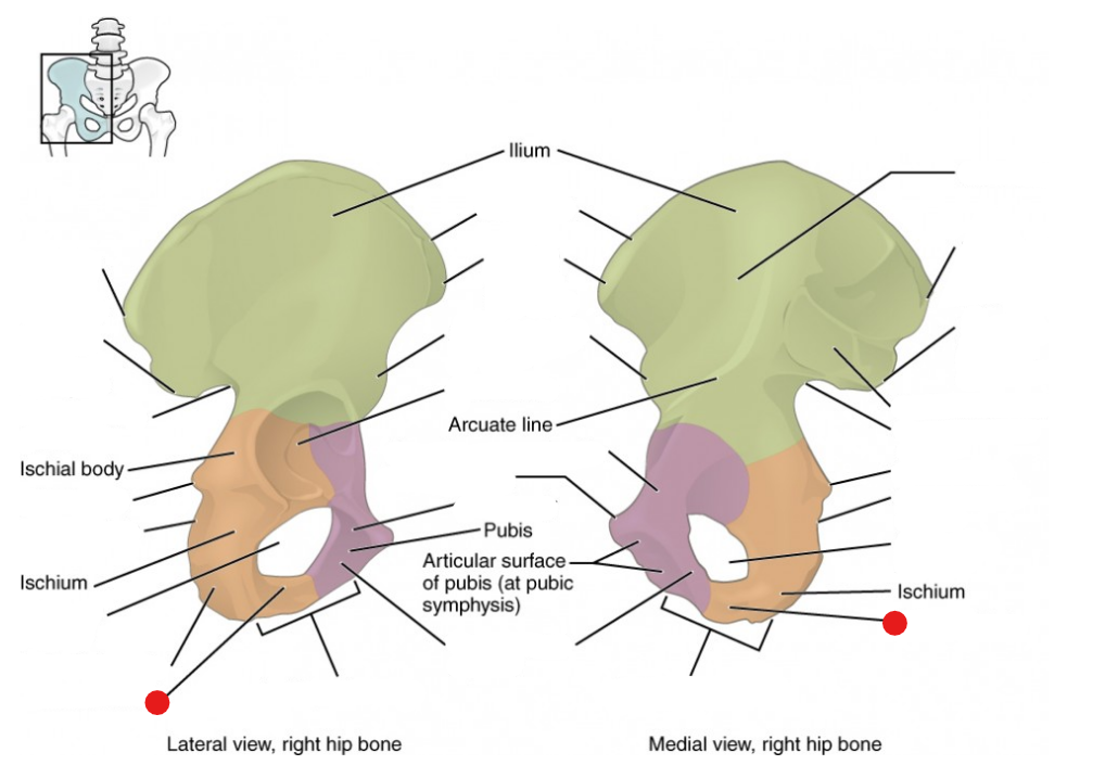 <p>Identify the structure pinned</p>
