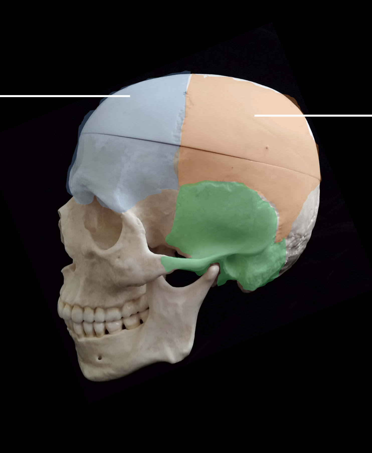 <p>Whats the green region highlighted?</p>