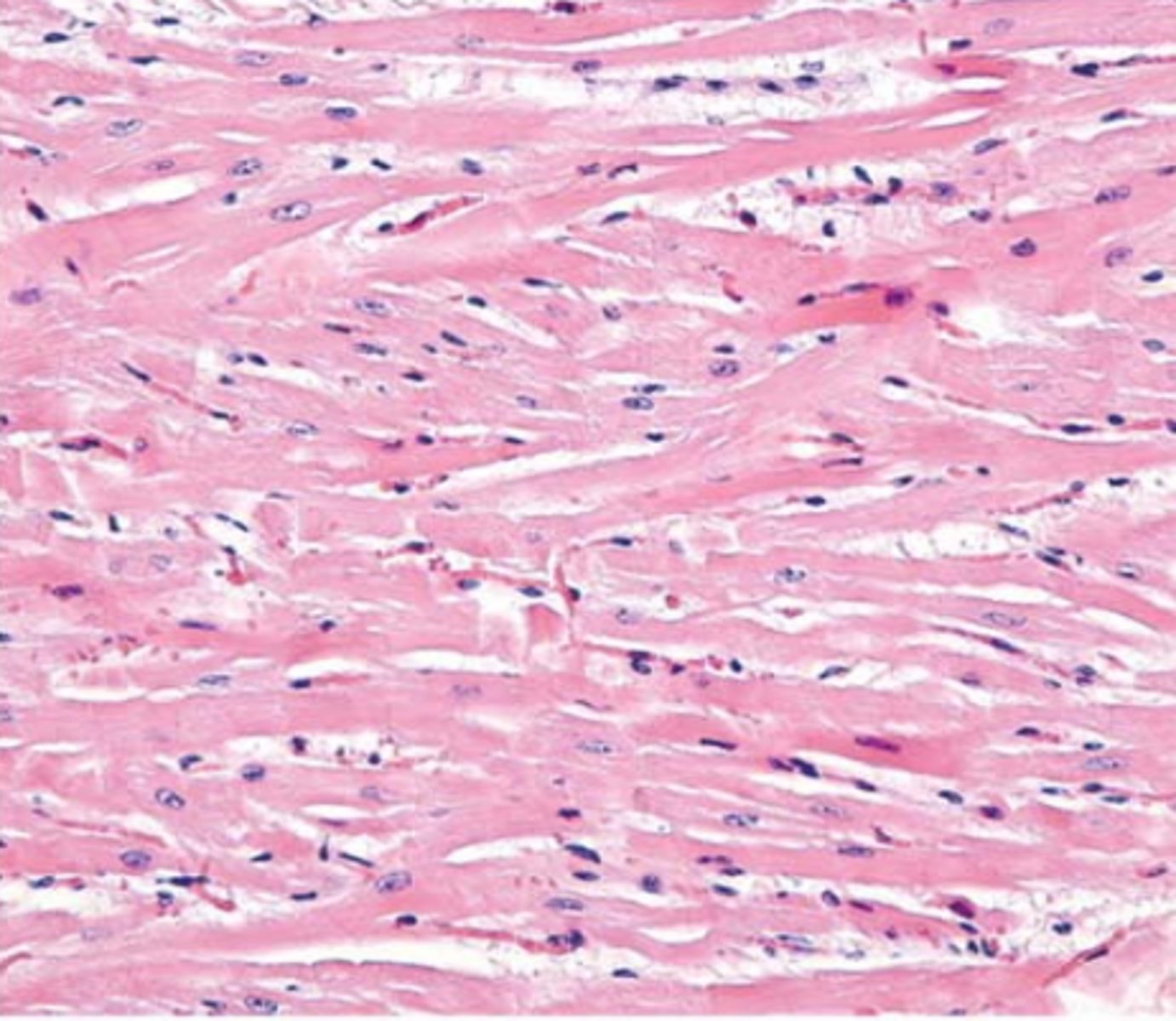 <p>Cardiac muscle cells.</p>