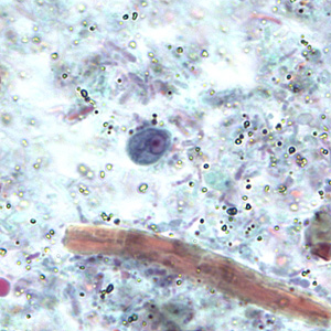 <p>4×6 um, pear shaped (resembles chilomastix), single large nucleus, 2 fibrils (bird beak arrangement)</p>