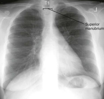 <p>PA Chest: Is this Image Good?</p>