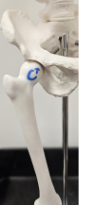 <p>ball and socket</p>