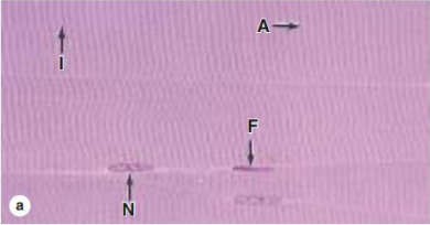 <p>skeleton muscle fibers have…</p>