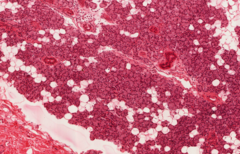 <p>what is the histological classification of this gland and it's anatomical name</p>