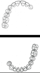 <p>What kennedy classification?</p>