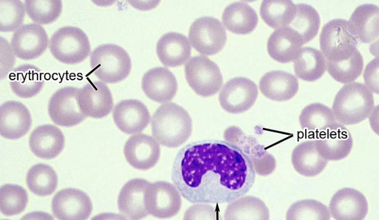 <p><span><span>large horseshoe-shaped nucleus with no granules</span></span></p><p class="s13"><span><span>○Attract other leukocytes</span></span></p><p class="s13"><span><span>○Associated with viral or fungal infections</span></span></p>