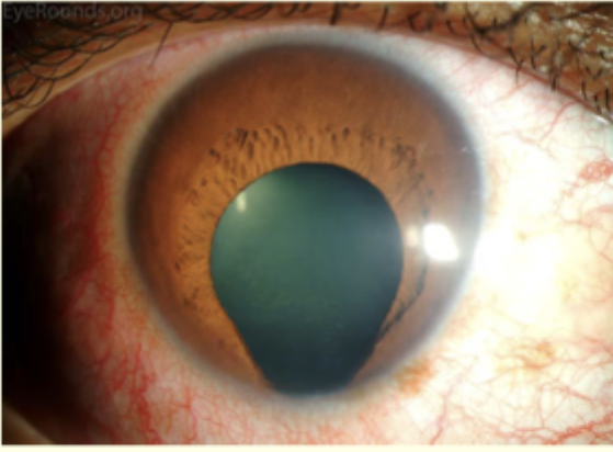 <p>Describe and give diagnosis </p>