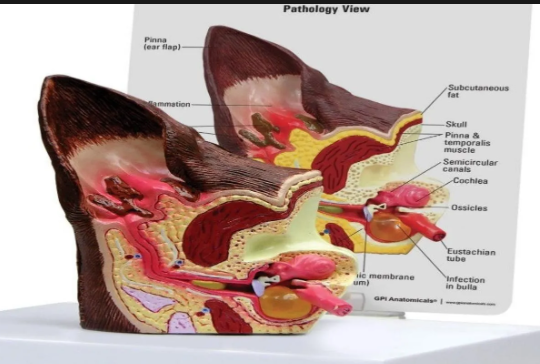 <p><span><strong>External ear:</strong></span> Includes pinna/auricula and ear canal; cartilage can be hyaline and elastic and extends to the tympanic membrane.</p><p><span><strong>Middle ear:</strong></span> Extends from tympanic membrane to auditory ossicles; contains malleus, incus, and stapes. Function is to amplify sound.</p><p><span><strong>Inner ear:</strong></span> Lies in the temporal bone and contains endolymph-filled canals and the cochlea.</p>