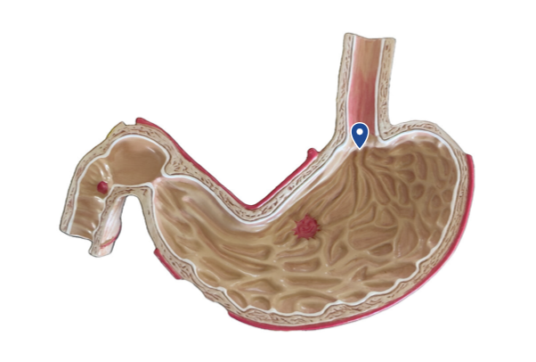 <p>Name this opening.</p>