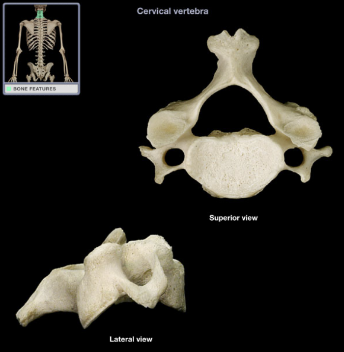<p>Cervical spinous process</p>