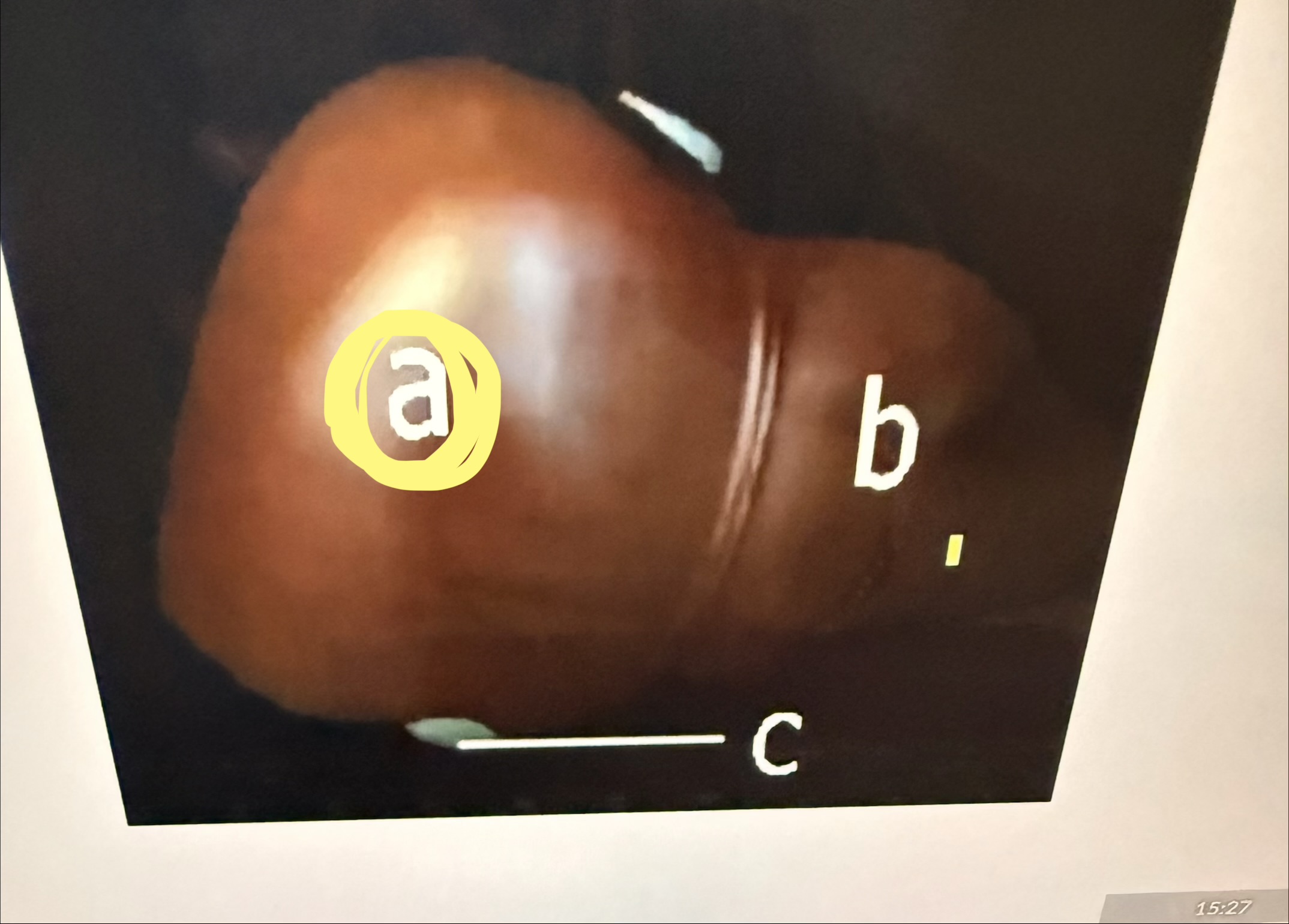 <p></p>