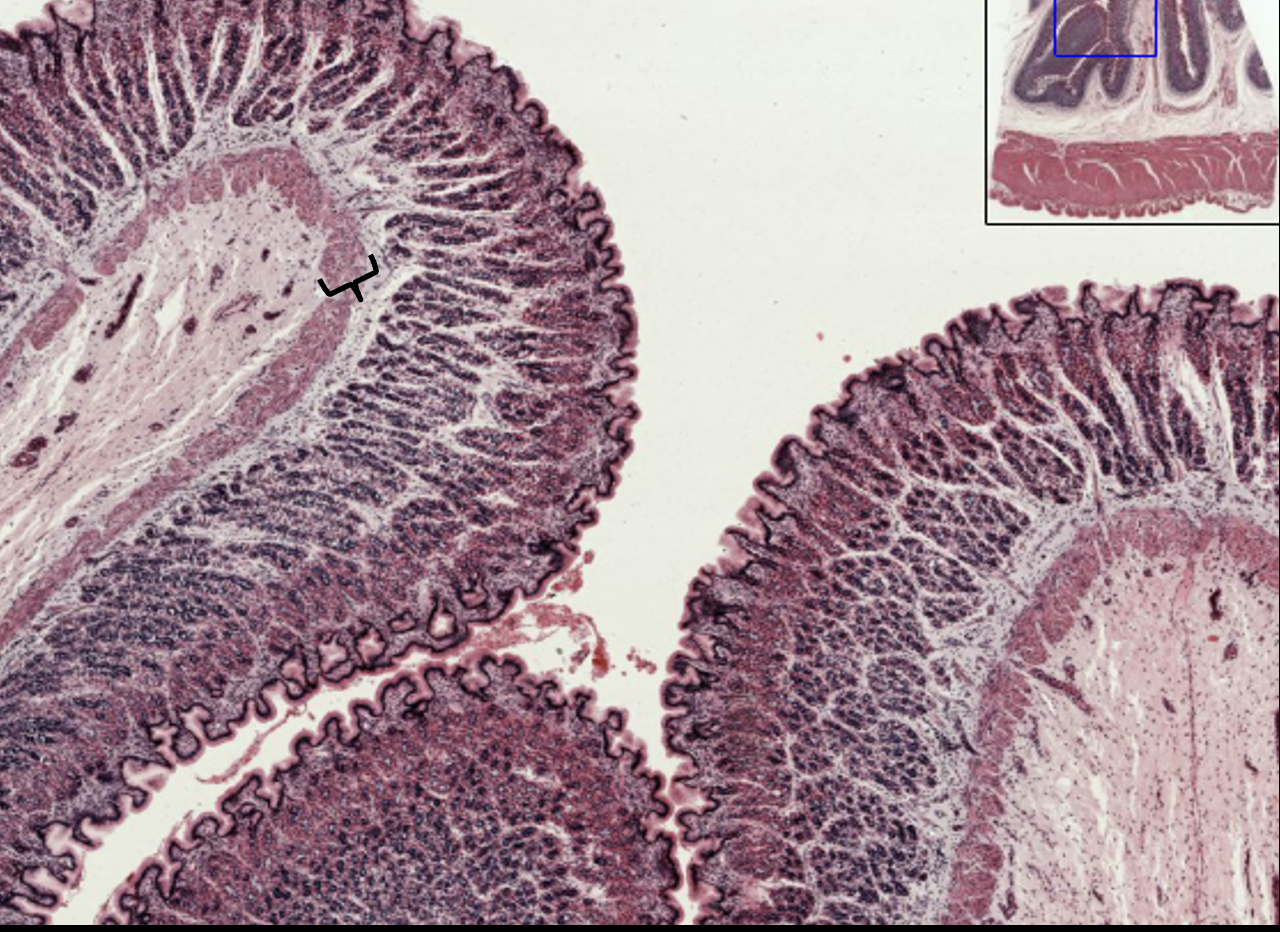 <p>What layer is this?</p>