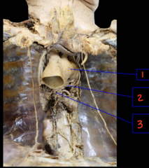 <p>What is labeled 3?</p>