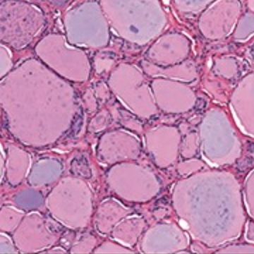 <p>thyroid gland </p>