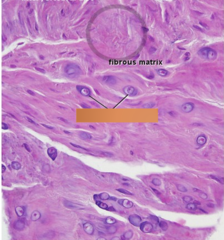 <p>Identify the type of cartilage cell.</p>