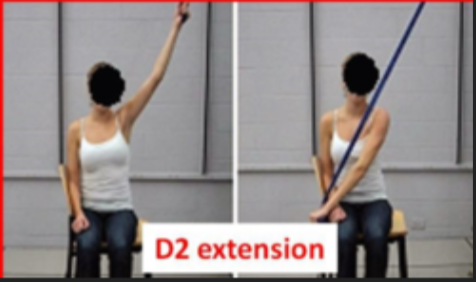 <ul><li><p>starts: the arm is flexed, abduction overhead on ipsilateral side </p></li><li><p>action: the arm moves diagonally down and across toward the opposite hip. As it moves the shoulder internally rotates and adducts, while the wrist and fingers into a fist </p></li></ul><p></p>