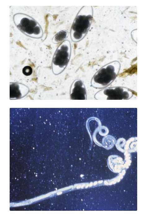 <p><u>Localisation:</u> SI of ruminants</p><p><u>Lifecycle:</u> Develop into [L3] within egg</p><ul><li><p>Slow development rate and survive at low temperatures</p></li><li><p>Requires chilling before hatching</p></li></ul><p><u>Pathogenesis:</u> Bigger issue in cold climates in spring (eg. Southland) as overwinters in high numbers (eggs resistant to cold)</p>
