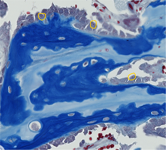 <p><span style="font-family: "Calibri Light";">1. Which cell organelles are encircled with yellow?<br><br>2. What are the small dark circles visible inside the encircled cell organelles?</span></p>