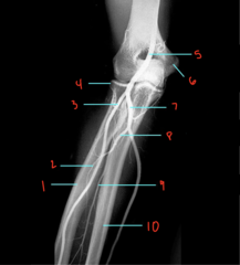 <p>What is labeled 2?</p>