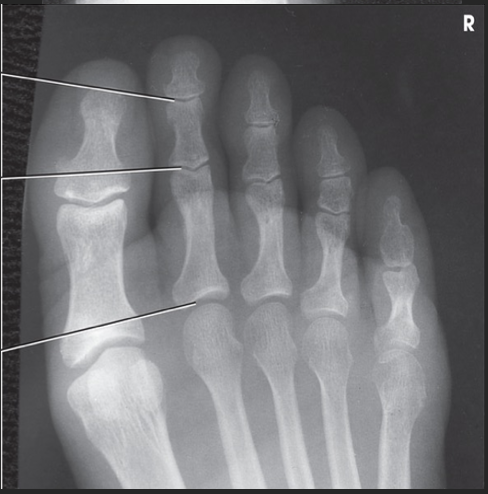 <p>How is the CR directed?</p>