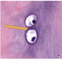 <p>Identify the specific region of the tissue in hyaline cartilage</p>