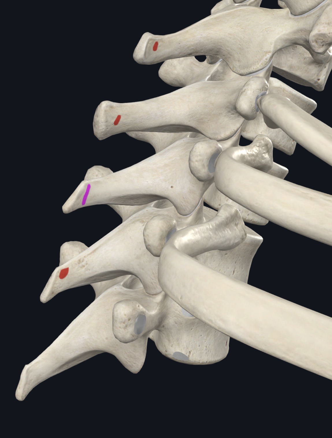 <p>Nuchal Ligament &amp; spinous process of C7-T6 vertebrae</p>