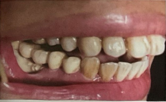 <p>CHẨN ĐOÁN?</p>