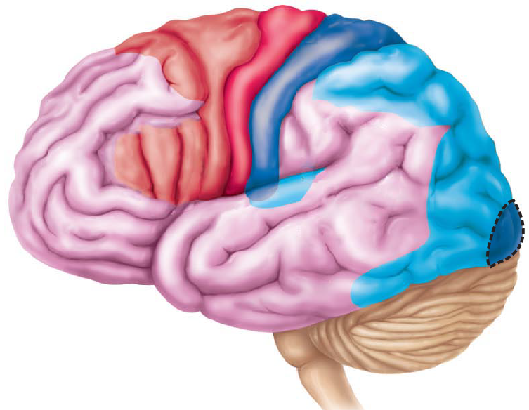 <p>Damage to the circled area may lead to what behavioral symptom?</p>