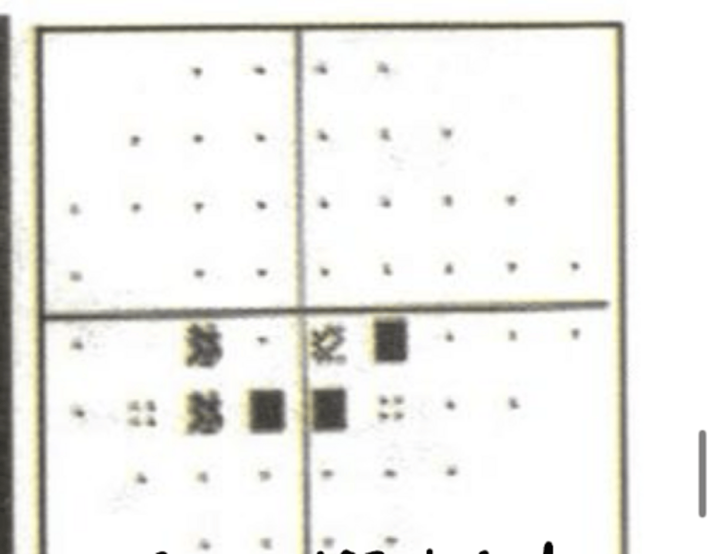 <p>Where is the VF defect?</p>