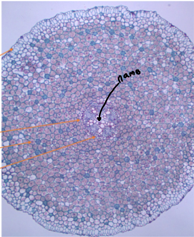 <ol><li><p>Name this part (<span>big holes in X)</span></p></li></ol><p></p>