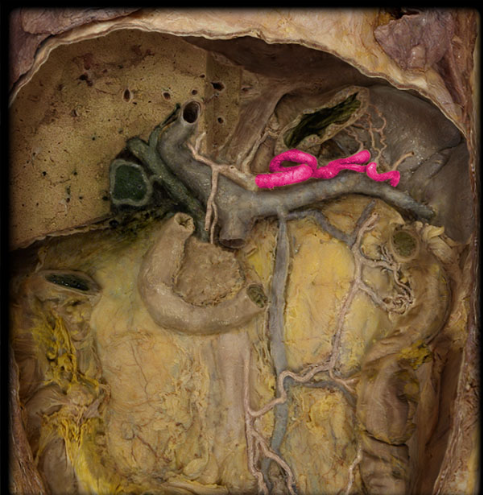 <ul><li><p><strong>Origin: </strong>Celic artery</p></li><li><p><strong>Course: </strong>Serpenmtine (snake-like) path of left along superior border of pancreas</p></li><li><p><strong>Distribution: </strong>Spleen, pacnreas, and stomach (fundus</p></li><li><p><strong>Branches:</strong></p></li><li><p><strong>Comment:</strong></p></li></ul><p></p>