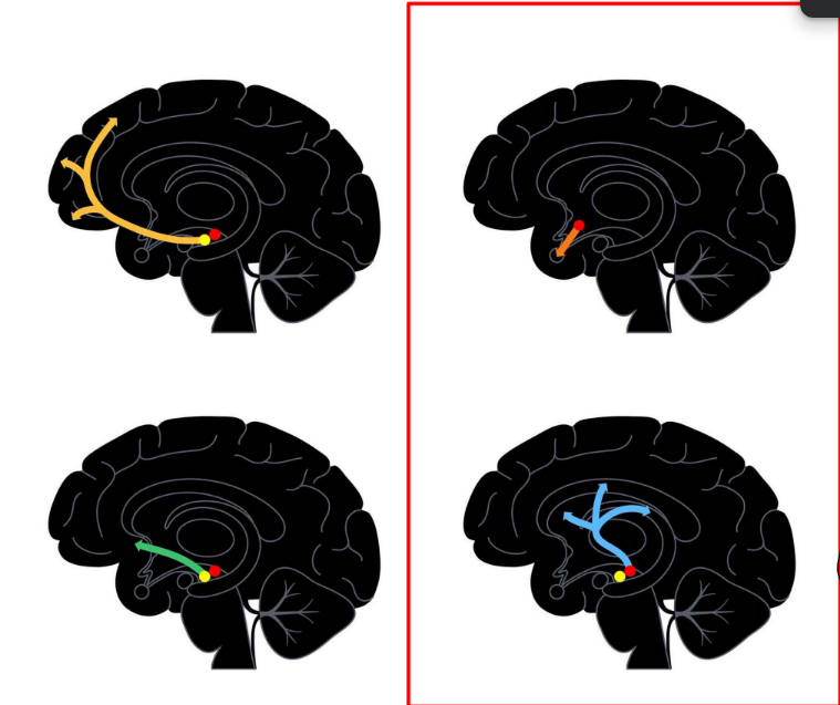 <p><u>for SCZ: DA hypothesis</u></p><p>def. antipsychotic medications/antipsychotics</p><ul><li><p>def. in terms of “typical” vs. “atypical” antipsychotics (& give ex. of each)</p></li></ul><p>__</p><p>what are the 2 main classes of DA Rs?</p><p>ALL DA Rs are __</p><p>__</p><p>name the brain’s 4 DA pathways</p><ul><li><p>each pathway does what general function?</p></li></ul><ul><li><p>which 2 relate to SCZ and mood disorders? how does this info relate to how to address SCZ & bipolar disorder treatment?</p></li></ul><p>label the picture w/ the brain’s 4 DA pathways</p>