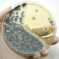 <p>Penicillium Mold (Asexual)</p>