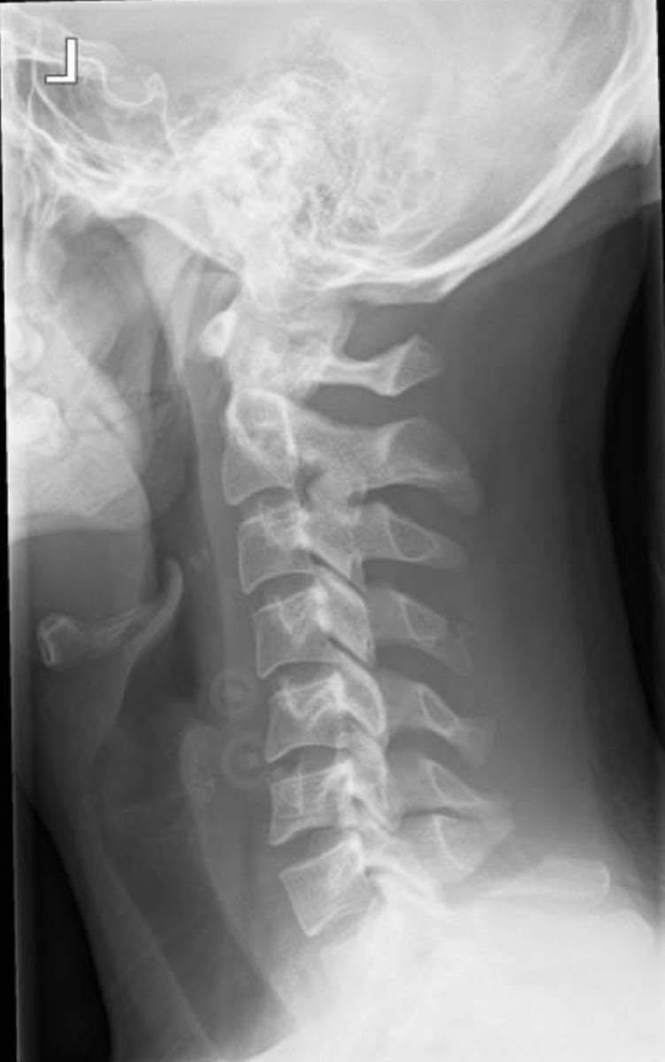 <p>What is the Finding &amp; Diagnosis?</p>